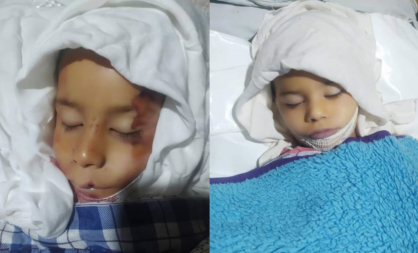 Two children killed as roof of house collapses in Kunduz 