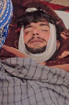 جلا جلا پېښو کې پنځه تنه مړه شوي