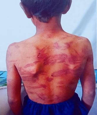 درې ماشومان د مېرې له بند او شکنجې وژغورل شول